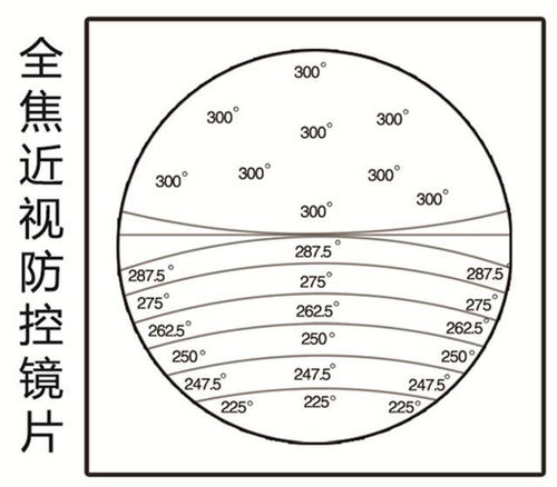 科技護(hù)眼新篇章 探秘摩爾視力佳全焦近視防控眼鏡的光學(xué)防控原理